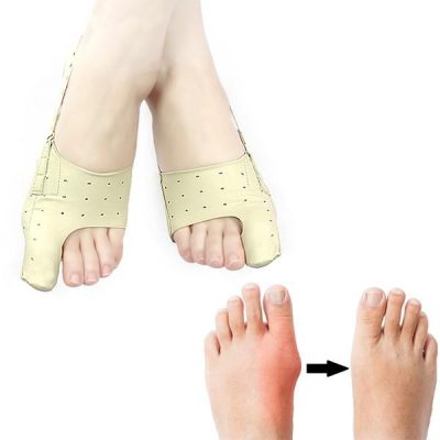Orthèses correctives d'hallux valgus ToeCorrect